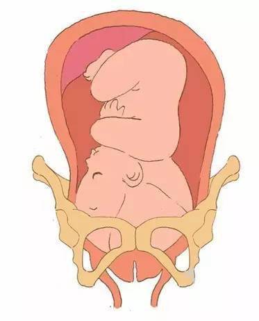 剖腹产后4个月后怀孕,剖腹产后四个月再次怀孕，风险与决策